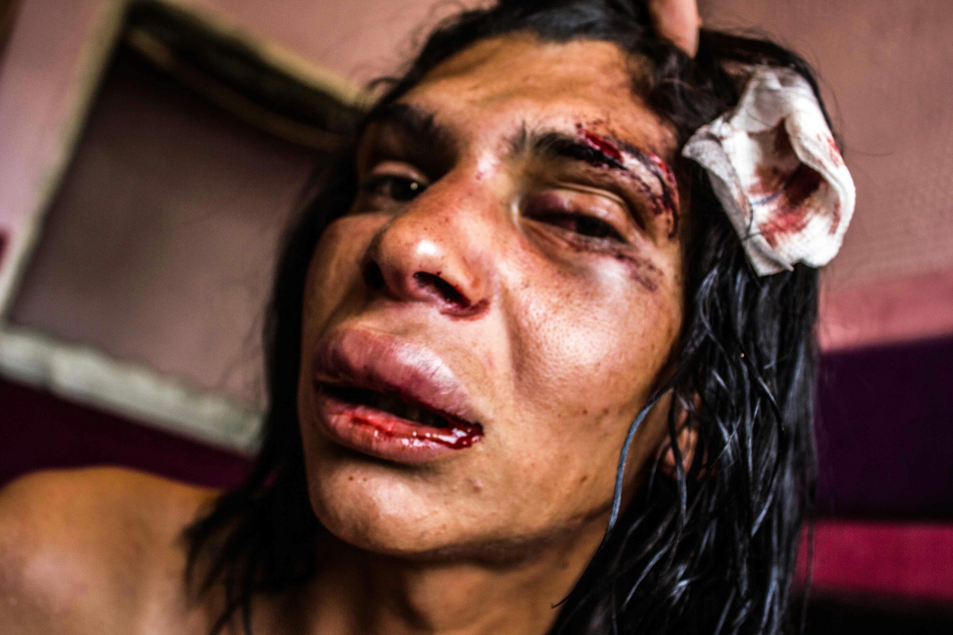 Documenting the violence facing Turkey's trans community