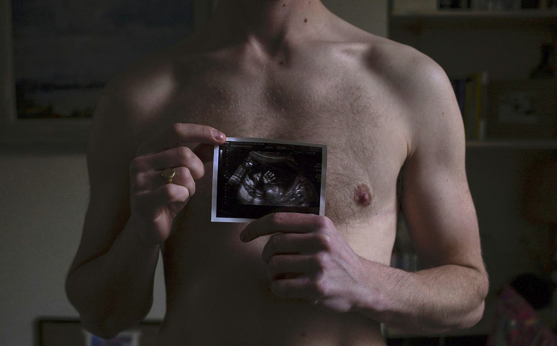 The reality of pregnancy as a transgender man