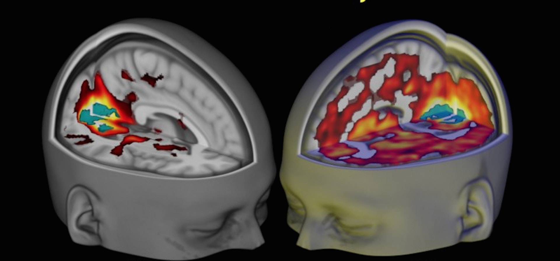 Scientists reveal world’s first images of the human brain on LSD
