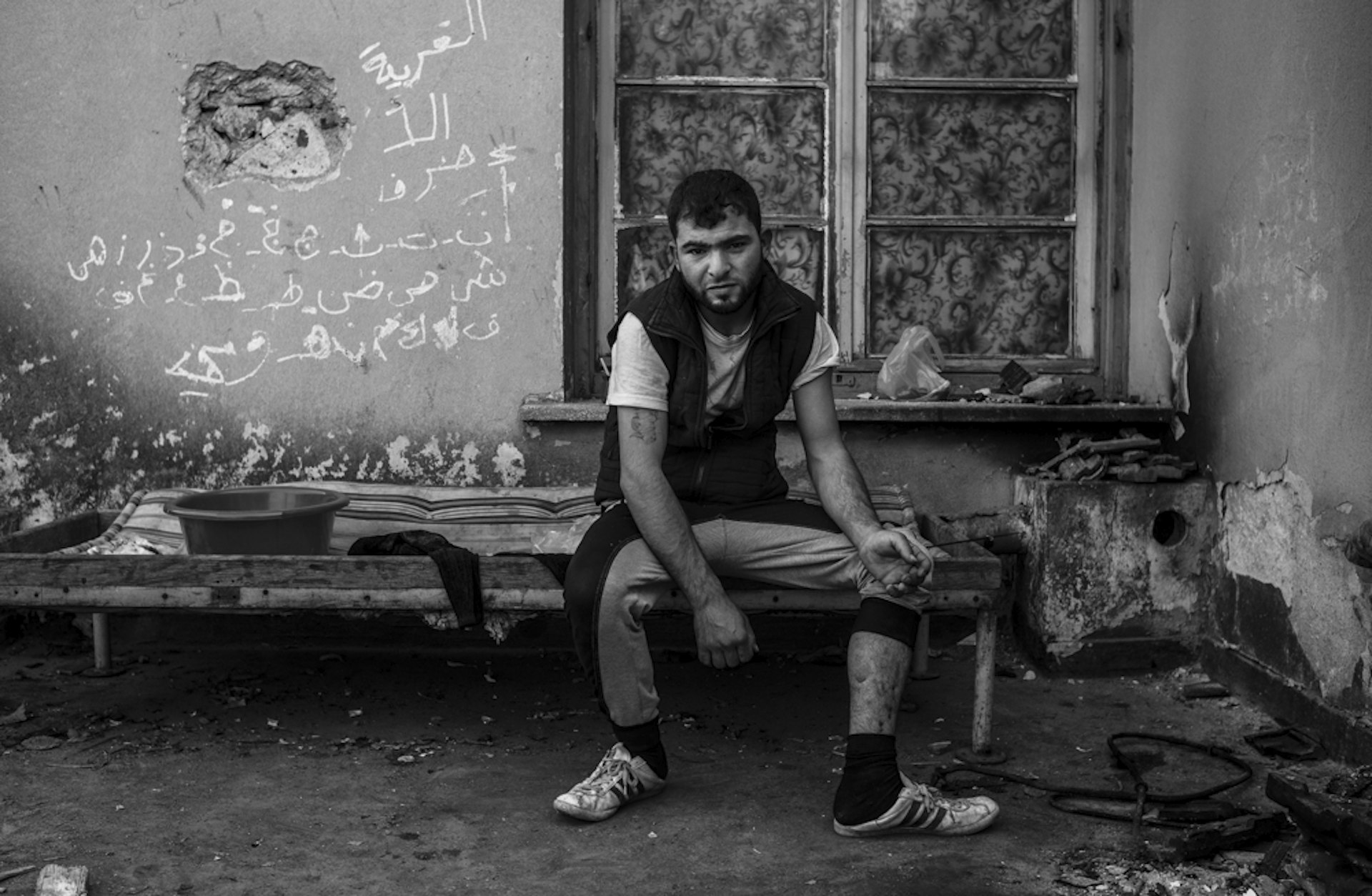 Ali sits on the roof of the Train station building in Idomeni, showing where he was shot in the leg by the Islamic State in Raqqa, Syria.