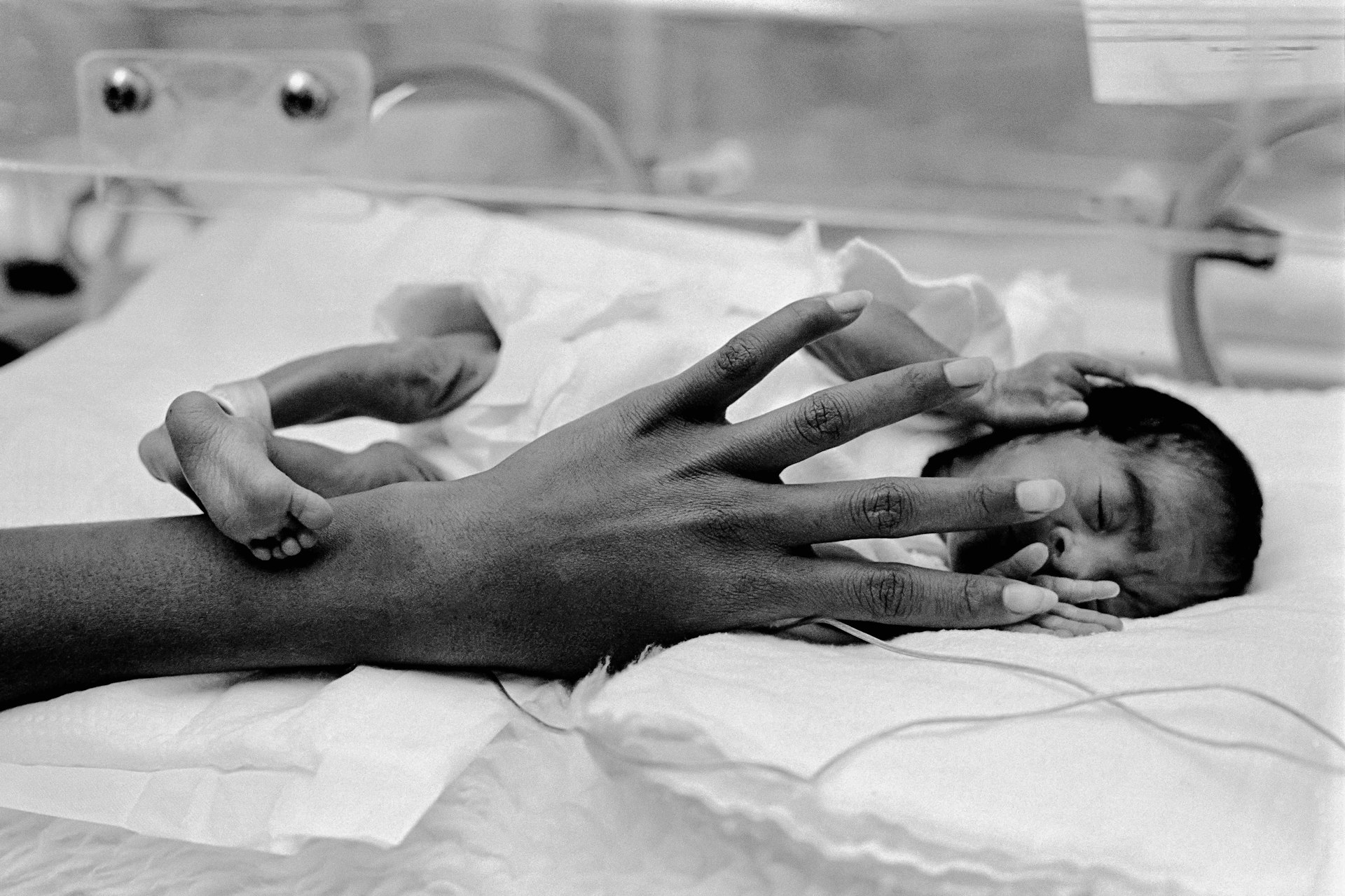 Phoenix. Preemie Baby unit at St Joseph's Hospital. She has a head too large by half for her body. With little to flesh them out, her features are skull-tight and wizaned. Her arms and legs are no thicker than her mothers fingers. Her ears have no cartilage. Not long ago she would have been a miscarried fetus, not a baby. To-day she is a Preemie baby, although barely 2lb, destined to survive to be a normal child. 1980.