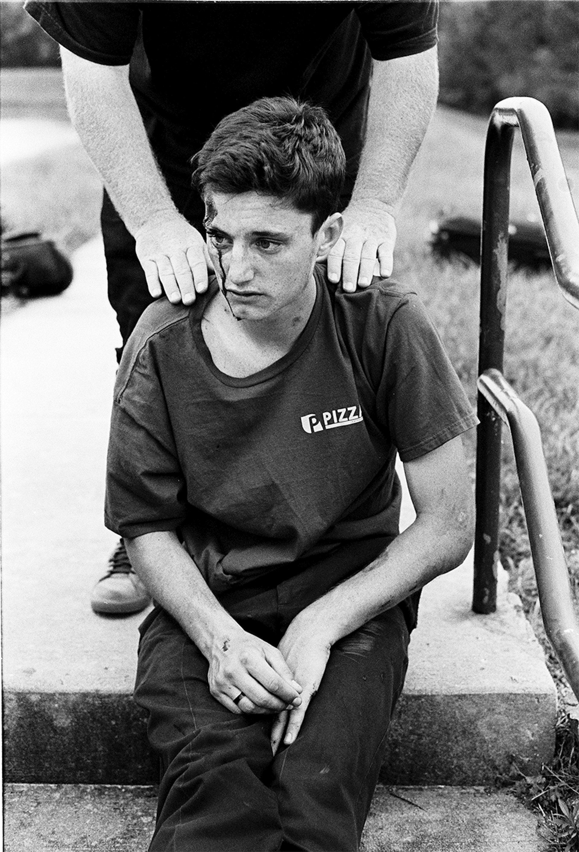 A young man sits on stairs with a bloodied head