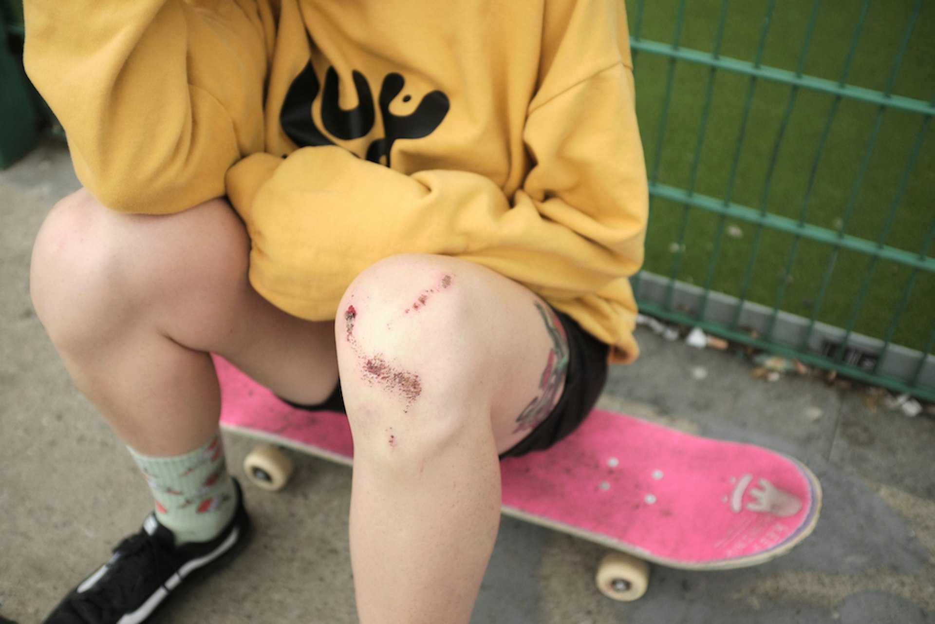 A skater sat on their skateboard in a yellow jumper, their grazed and bloodied knees on display